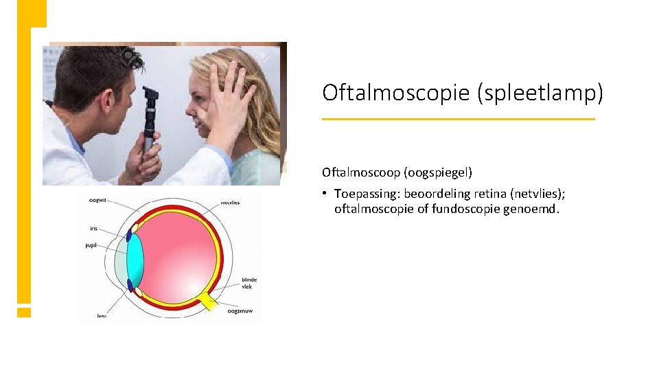 Oftalmoscopie (spleetlamp) Oftalmoscoop (oogspiegel) • Toepassing: beoordeling retina (netvlies); oftalmoscopie of fundoscopie genoemd. 