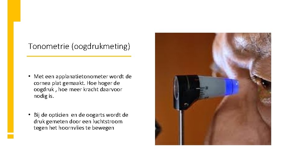 Tonometrie (oogdrukmeting) • Met een applanatietonometer wordt de cornea plat gemaakt. Hoe hoger de