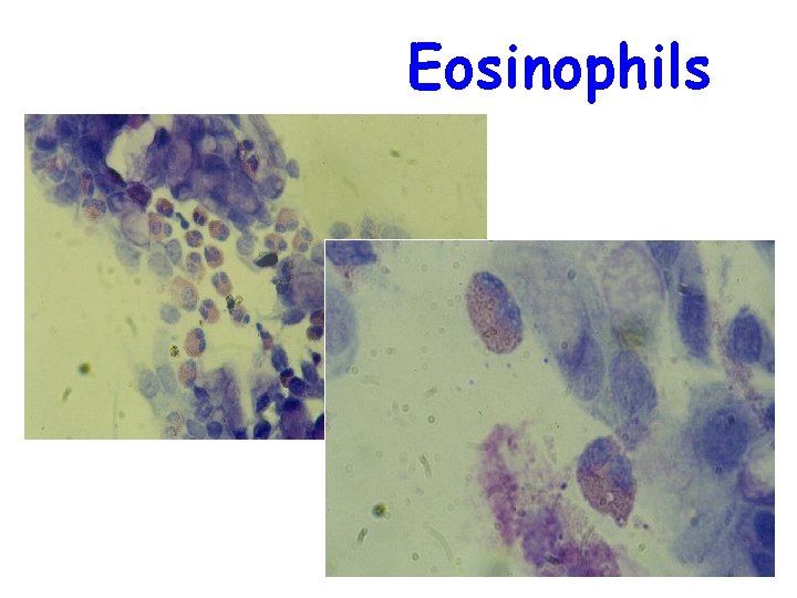 Eosinophils 
