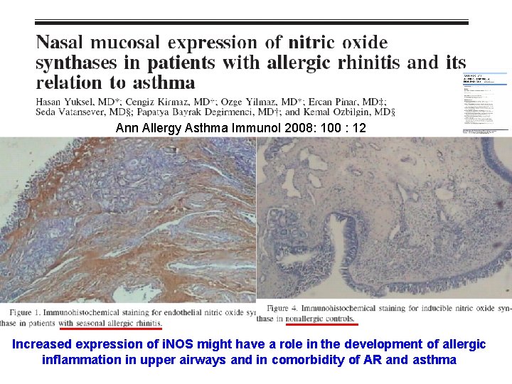 Ann Allergy Asthma Immunol 2008: 100 : 12 Increased expression of i. NOS might