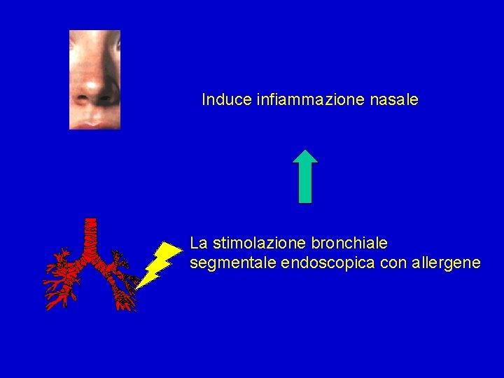 Induce infiammazione nasale La stimolazione bronchiale segmentale endoscopica con allergene 