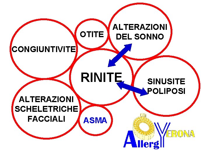 OTITE ALTERAZIONI DEL SONNO CONGIUNTIVITE RINITE ALTERAZIONI SCHELETRICHE FACCIALI ASMA SINUSITE POLIPOSI 