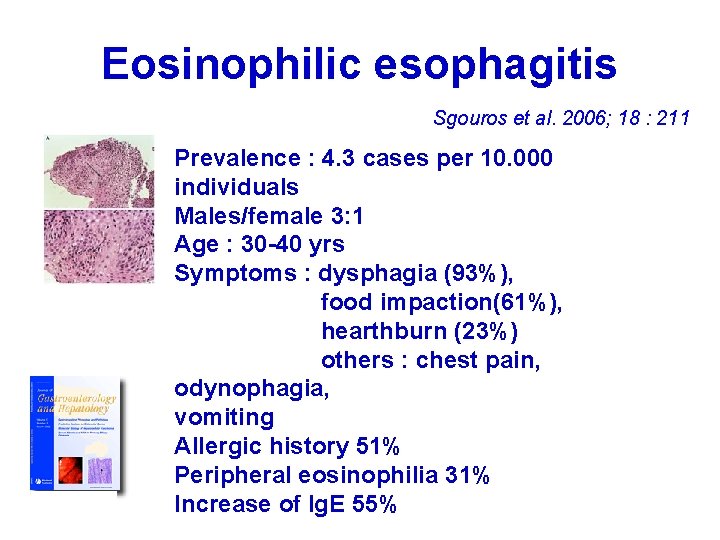 Eosinophilic esophagitis Sgouros et al. 2006; 18 : 211 Prevalence : 4. 3 cases