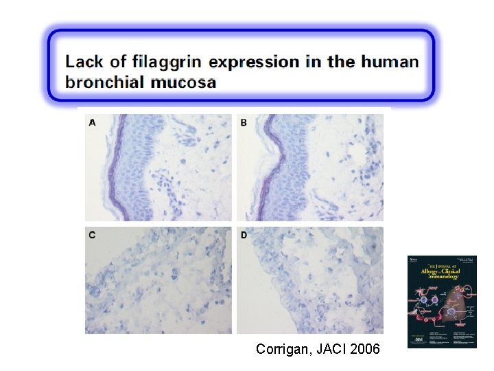 Corrigan, JACI 2006 