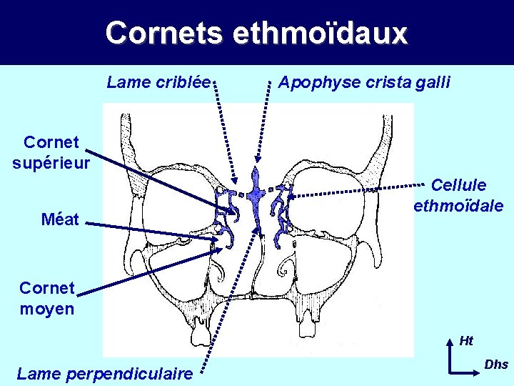 Cornets ethmoïdaux Lame criblée Apophyse crista galli Cornet supérieur Méat Cellule ethmoïdale Cornet moyen