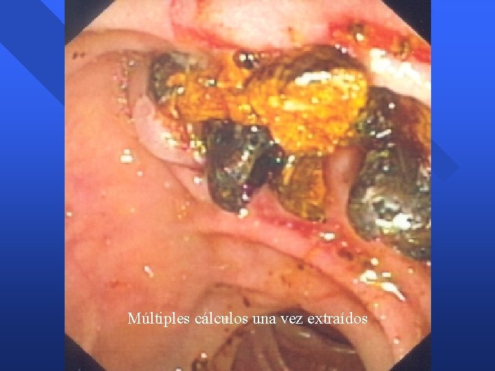 Múltiples cálculos una vez extraídos Múltiples cálculos una vez extraídos