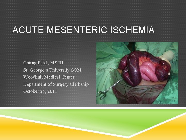 ACUTE MESENTERIC ISCHEMIA Chirag Patel, MS III St. George’s University SOM Woodhull Medical Center