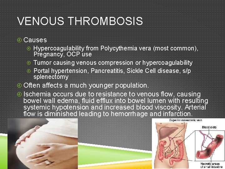 VENOUS THROMBOSIS Causes Hypercoagulability from Polycythemia vera (most common), Pregnancy, OCP use Tumor causing
