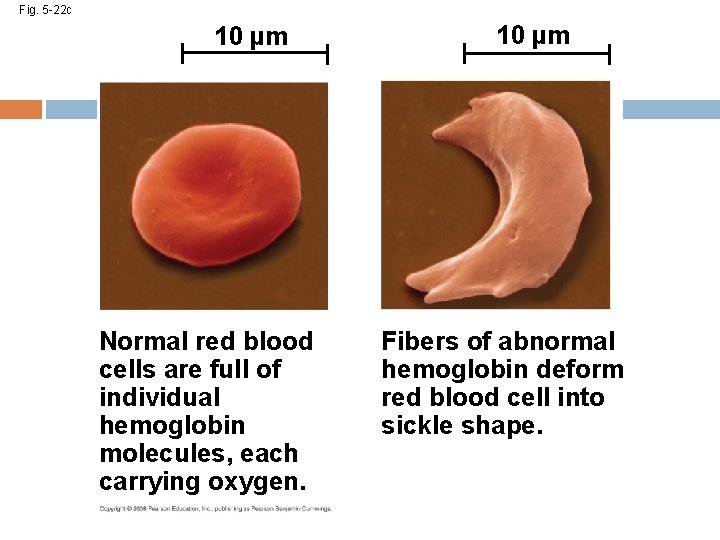 Fig. 5 -22 c 10 µm Normal red blood cells are full of individual