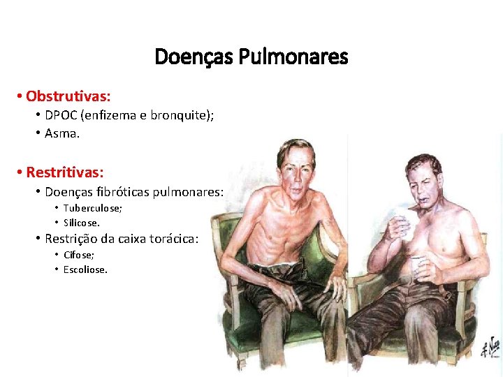 Doenças Pulmonares • Obstrutivas: • DPOC (enfizema e bronquite); • Asma. • Restritivas: •