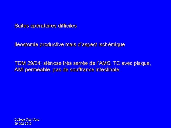 Suites opératoires difficiles Iléostomie productive mais d’aspect ischémique TDM 29/04: sténose très serrée de