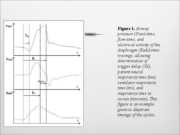 Figure 1. Airway pressure (Paw)-time, flow-time, and electrical activity of the diaphragm (Eadi)-time tracings,