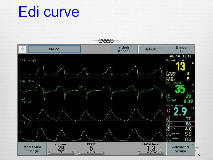 Edi curve 67 67 