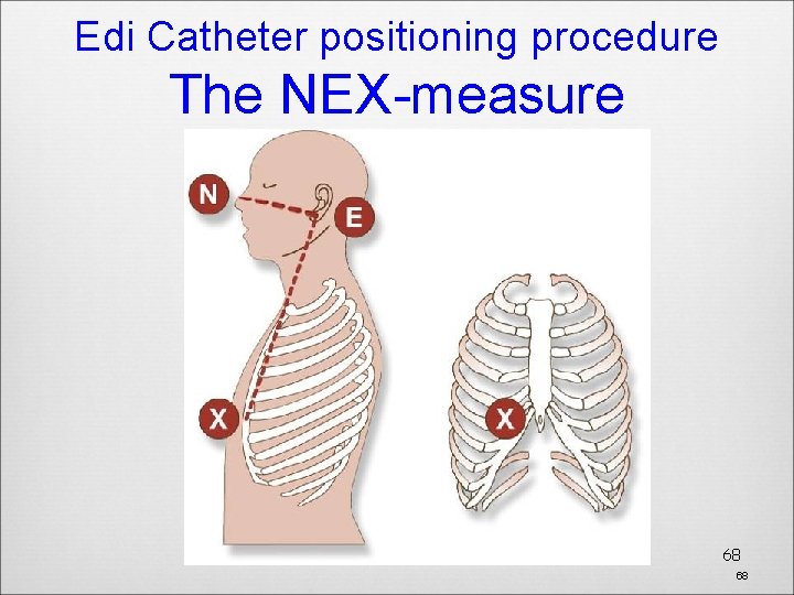 Edi Catheter positioning procedure The NEX-measure 68 68 