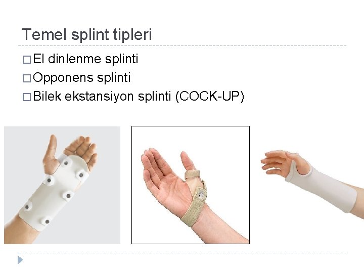 Temel splint tipleri � El dinlenme splinti � Opponens splinti � Bilek ekstansiyon splinti