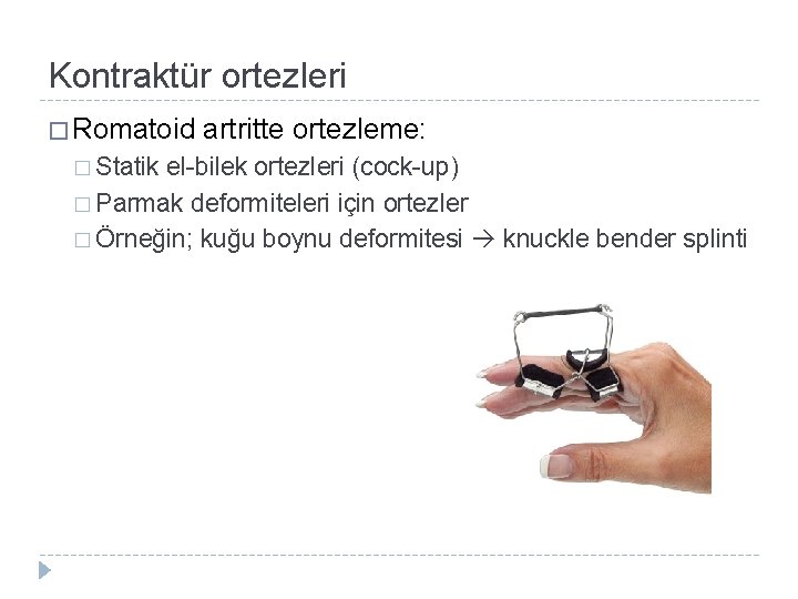 Kontraktür ortezleri � Romatoid � Statik artritte ortezleme: el-bilek ortezleri (cock-up) � Parmak deformiteleri Kontraktür ortezleri � Romatoid � Statik artritte ortezleme: el-bilek ortezleri (cock-up) � Parmak deformiteleri