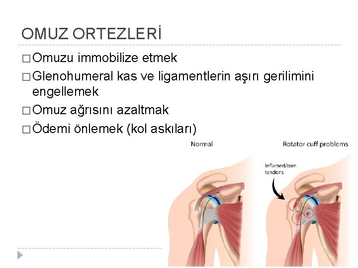 OMUZ ORTEZLERİ � Omuzu immobilize etmek � Glenohumeral kas ve ligamentlerin aşırı gerilimini engellemek