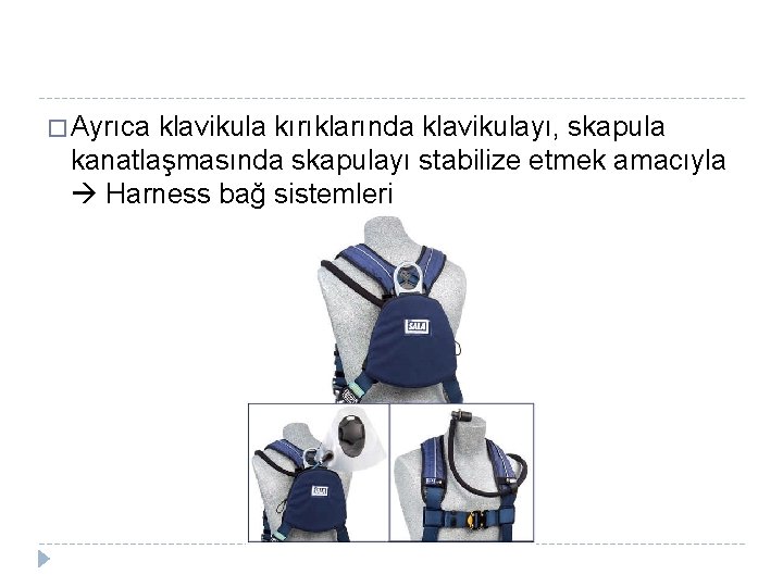 � Ayrıca klavikula kırıklarında klavikulayı, skapula kanatlaşmasında skapulayı stabilize etmek amacıyla Harness bağ sistemleri � Ayrıca klavikula kırıklarında klavikulayı, skapula kanatlaşmasında skapulayı stabilize etmek amacıyla Harness bağ sistemleri