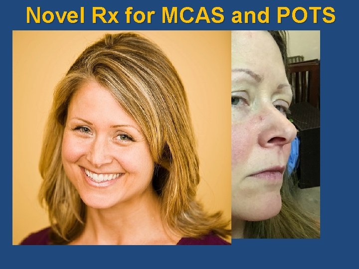 Novel Rx for MCAS and POTS Novel Rx for MCAS and POTS