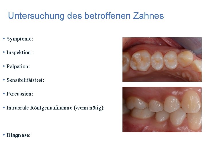 Untersuchung des betroffenen Zahnes • Symptome: • Inspektion : • Palpation: • Sensibilitätstest: •