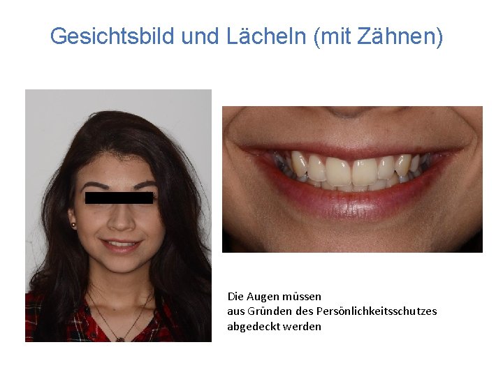 Gesichtsbild und Lächeln (mit Zähnen) Die Augen müssen aus Gründen des Persönlichkeitsschutzes abgedeckt werden