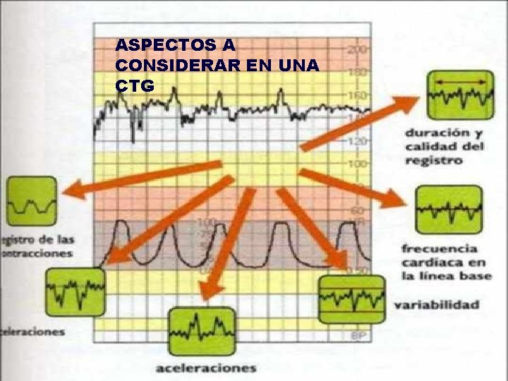 ASPECTOS A CONSIDERAR EN UNA CTG 