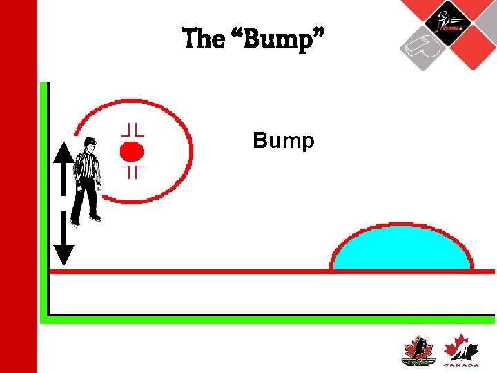 The “Bump” Bump 