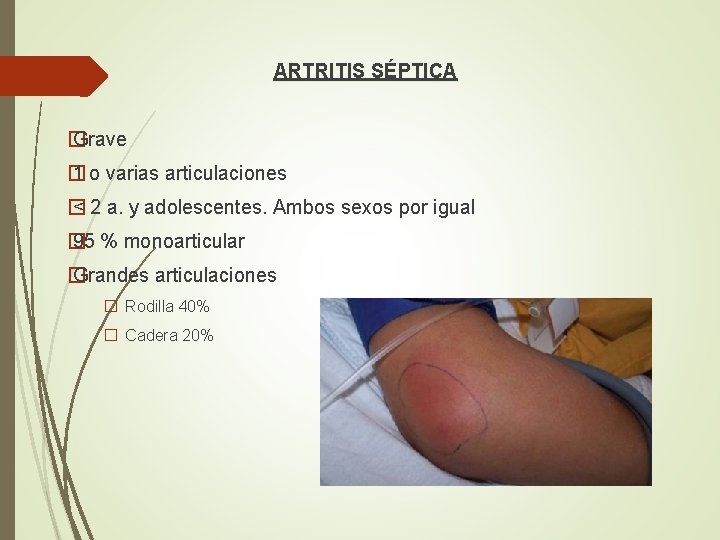 ARTRITIS SÉPTICA � Grave � 1 o varias articulaciones � < 2 a. y