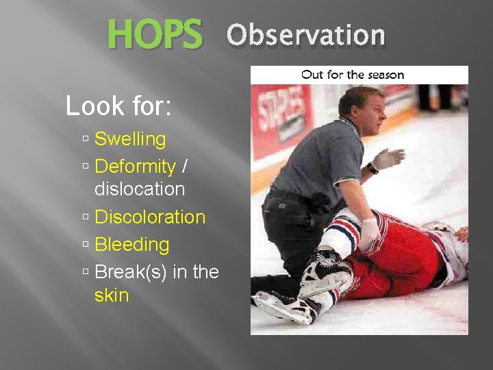 HOPS Look for: Swelling Deformity / dislocation Discoloration Bleeding Break(s) in the skin Observation
