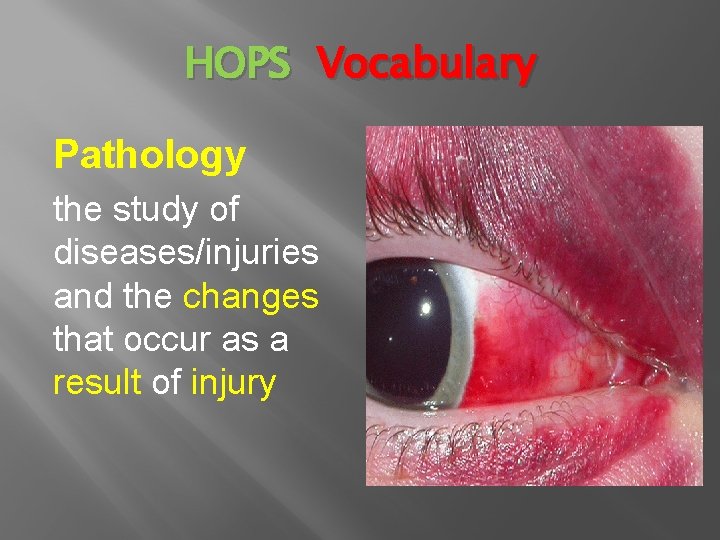 HOPS Vocabulary Pathology the study of diseases/injuries and the changes that occur as a