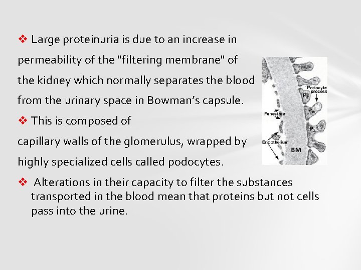 v Large proteinuria is due to an increase in permeability of the "filtering membrane"