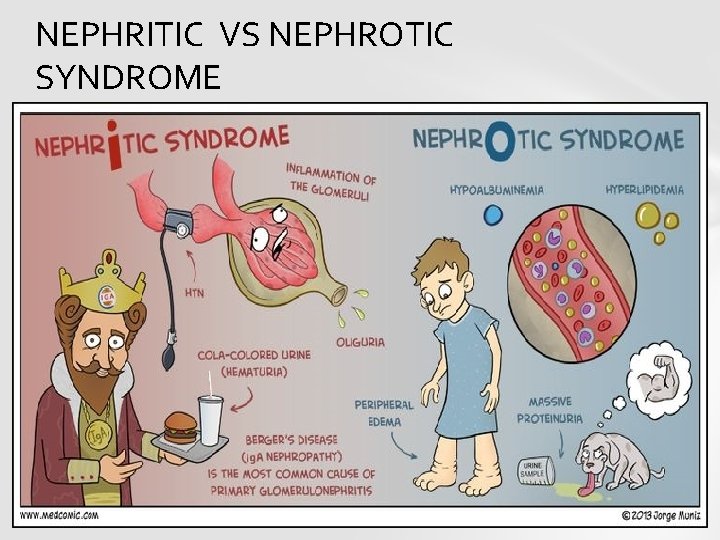 NEPHRITIC VS NEPHROTIC SYNDROME 