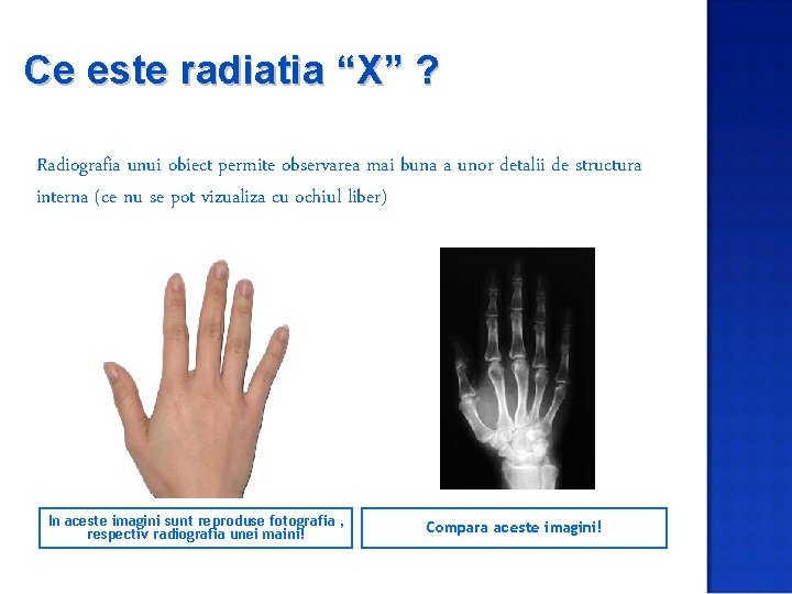 Ce este radiatia “X” ? Radiografia unui obiect permite observarea mai buna a unor