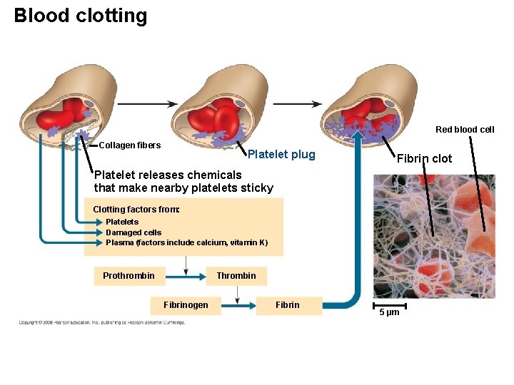 Blood clotting Red blood cell Collagen fibers Platelet plug Fibrin clot Platelet releases chemicals