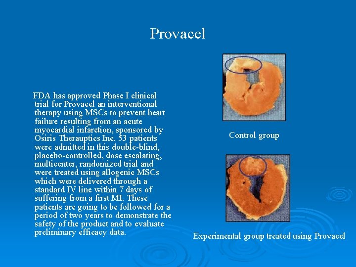 Provacel FDA has approved Phase I clinical trial for Provacel an interventional therapy using