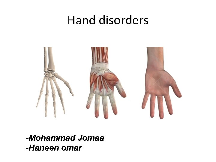 Hand disorders -Mohammad Jomaa -Haneen omar Hand disorders -Mohammad Jomaa -Haneen omar