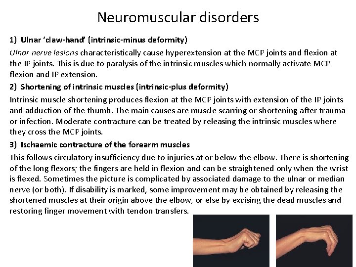 Neuromuscular disorders 1) Ulnar ‘claw-hand’ (intrinsic-minus deformity) Ulnar nerve lesions characteristically cause hyperextension at