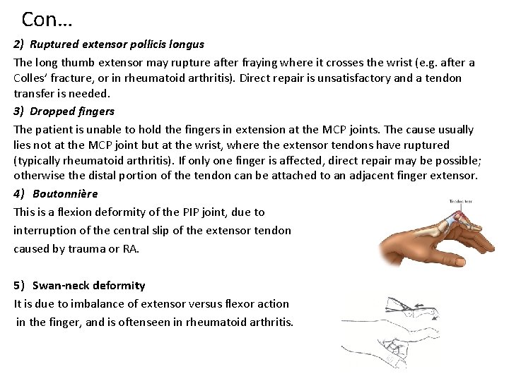 Con… 2) Ruptured extensor pollicis longus The long thumb extensor may rupture after fraying