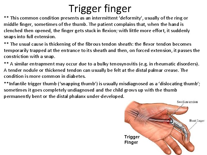 Trigger finger ** This common condition presents as an intermittent ‘deformity’, usually of the