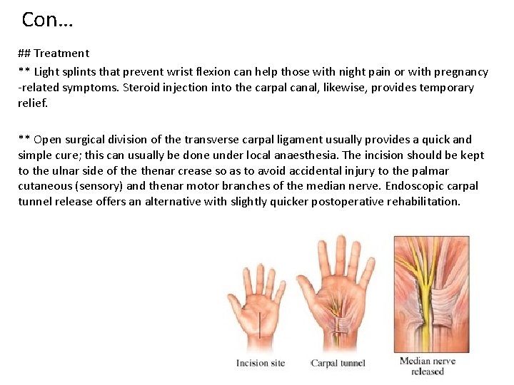 Con… ## Treatment ** Light splints that prevent wrist flexion can help those with