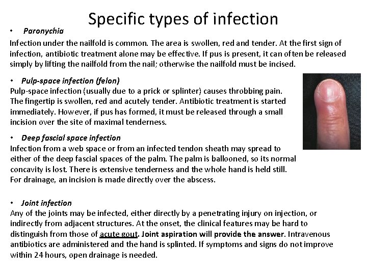 Specific types of infection • Paronychia Infection under the nailfold is common. The area
