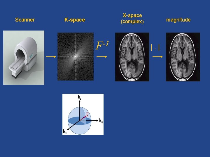 Scanner X-space (complex) K-space F-1 magnitude |. | 