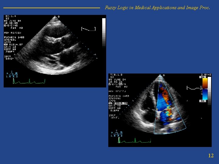 Fuzzy Logic in Medical Applications and Image Proc. 12 
