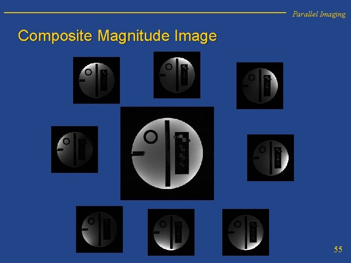 Parallel Imaging Composite Magnitude Image 55 