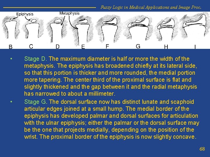 Fuzzy Logic in Medical Applications and Image Proc. • • Stage D. The maximum