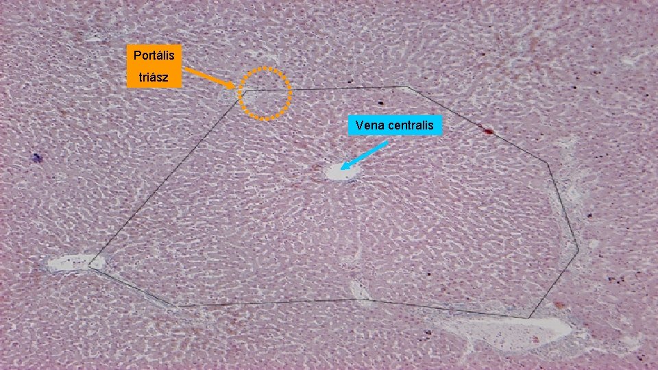 Portális triász Vena centralis 