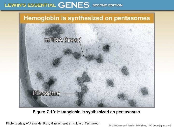 Figure 7. 10: Hemoglobin is synthesized on pentasomes. Photo courtesy of Alexander Rich, Massachusetts