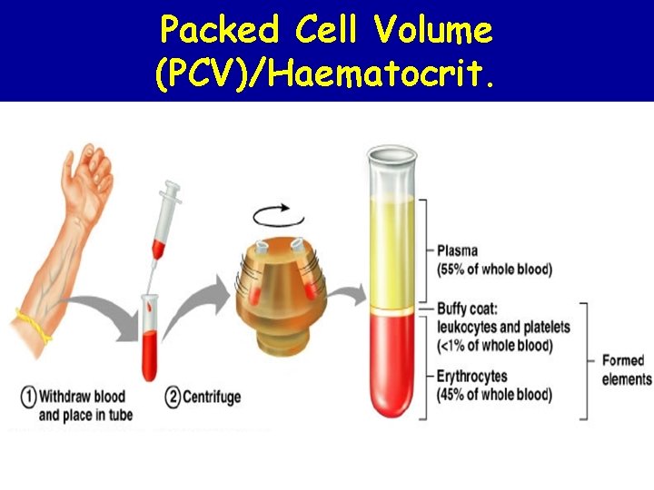 Packed Cell Volume (PCV)/Haematocrit. 