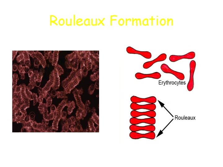 Rouleaux Formation 