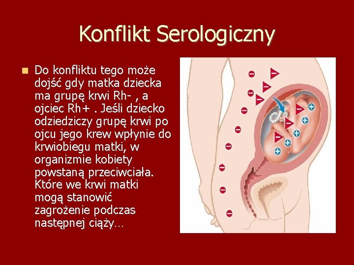 Konflikt Serologiczny Do konfliktu tego może dojść gdy matka dziecka ma grupę krwi Rh-